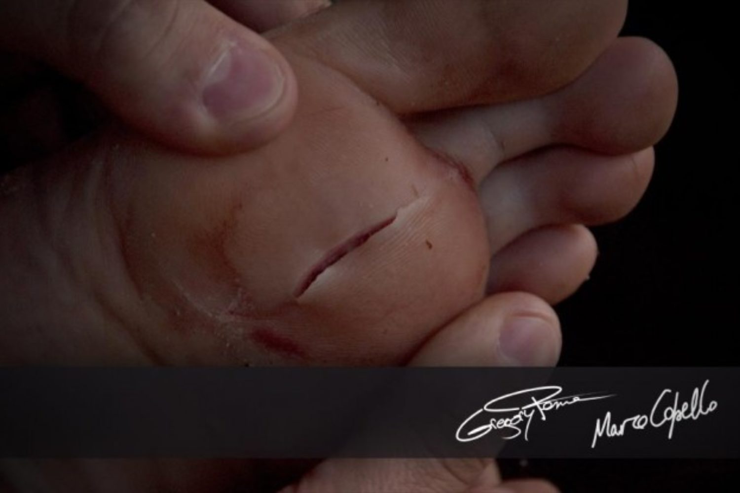 Le corail ça fait mal - Happy coral injury