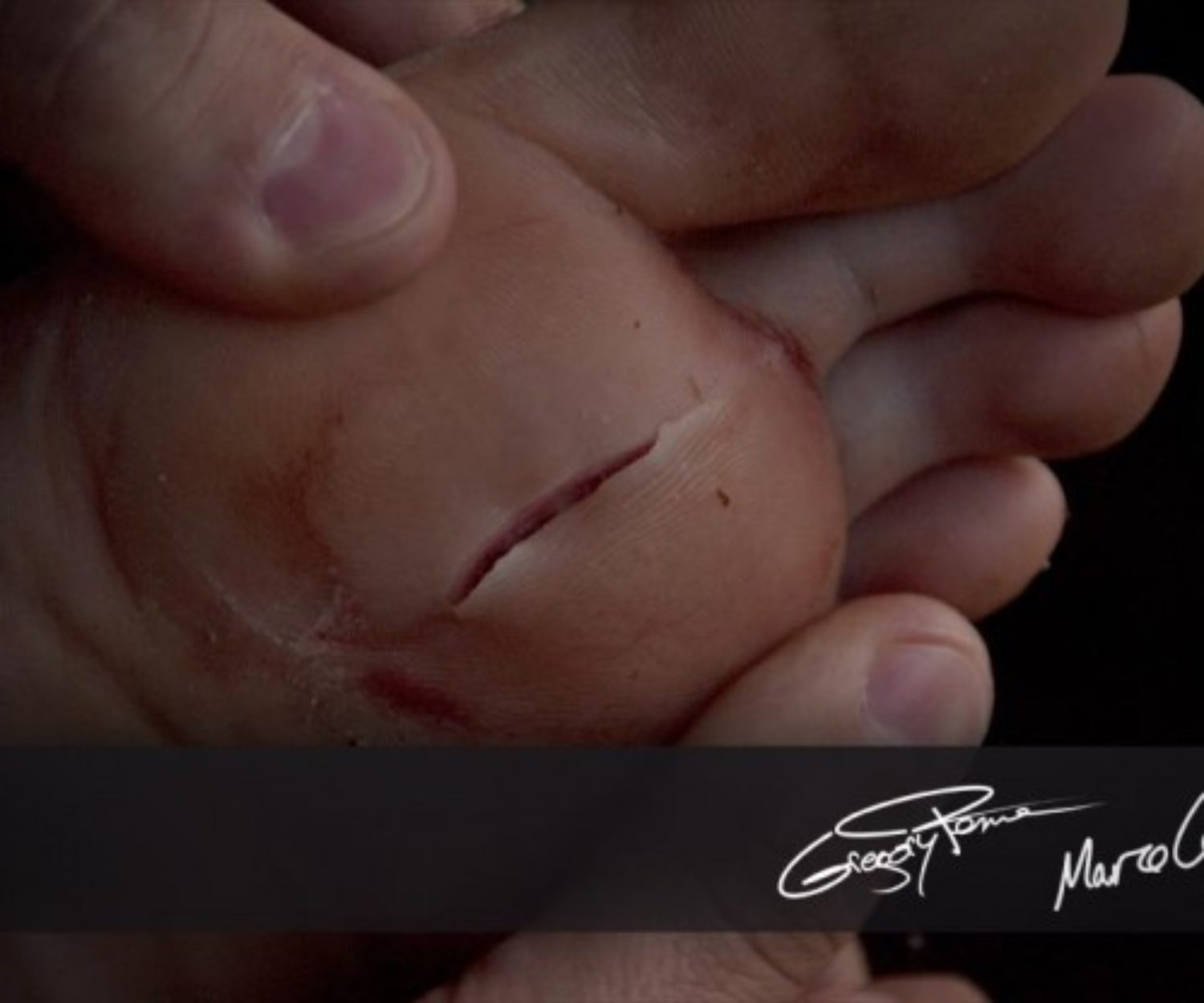 Le corail ça fait mal - Happy coral injury